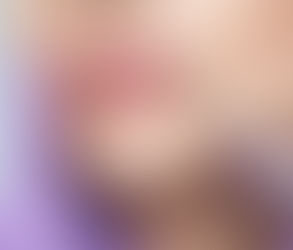 حقن الفيلر للشفاه مقابل جراحة تكبير الشفاه