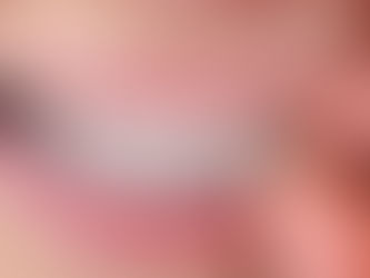 How to Clean Your Clear Retainer: A Step-by-Step Guide