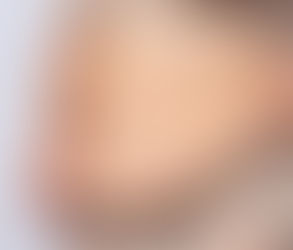 ما مدى أمان جراحة إنقاص الوزن لكبار السن؟