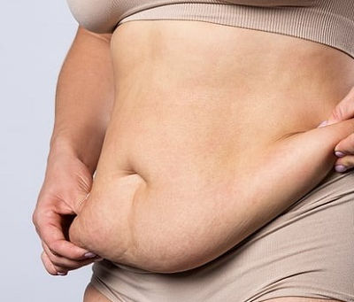 ما مدى أمان جراحة إنقاص الوزن لكبار السن؟