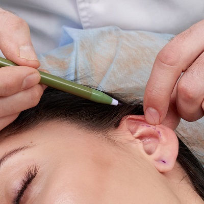 أفضل تجميل الأذني