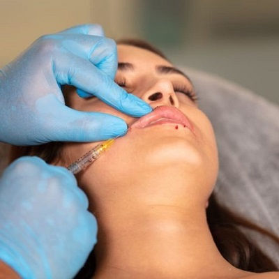 Best Lip Fillers Injections Muscat