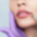 Reversing Lip Augmentation: Muscat’s Solutions for Overfilled Lips