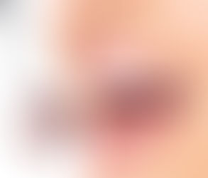 Can Teeth Whitening Damage Tooth Enamel?