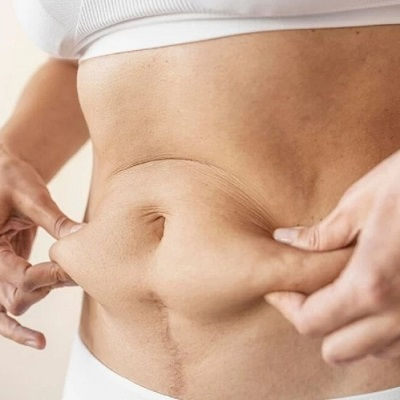 Best Vaser 4D Liposuction Oman