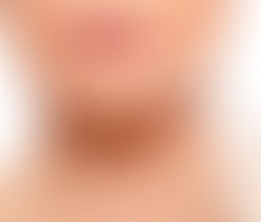 How Restylane Fillers Can Lift and Sculpt the Face in Muscat