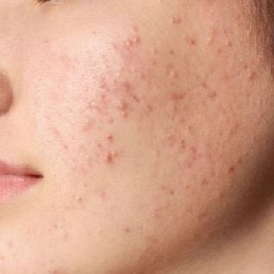 Best Dermatologist in Oman