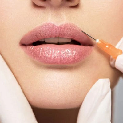 أفضل حقن فيلر الشفاه مسقط