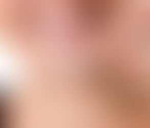 Networking with Other Aligner Patients: Building Community in Dubai