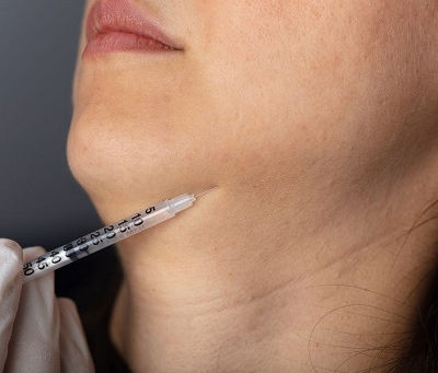 Jawline Filler Injections for a Chiseled Jawline: Before and After