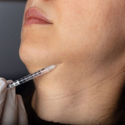 Jawline Fillers Injections in Oman