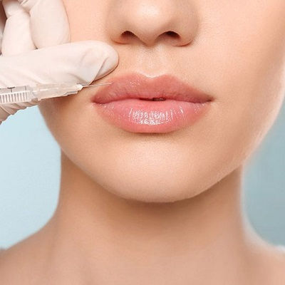 Lip Fillers Injections Clinic in Muscat