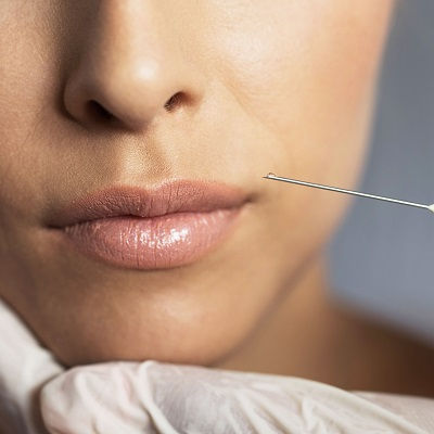 Lip Fillers Injections in Muscat