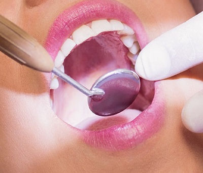 What Should I Expect After Wisdom Tooth Removal in Dubai?