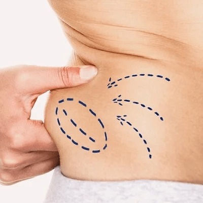 Best Fat Melting Injections in Muscat