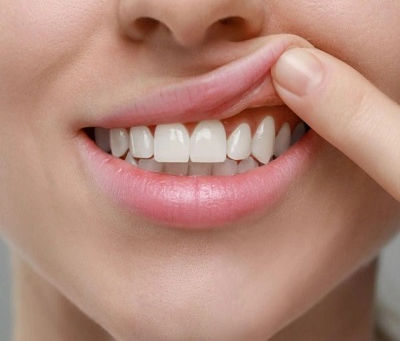 Common Myths About Gum Contouring Debunked