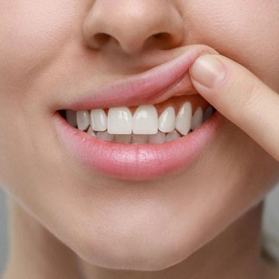 Best Gum Contouring in Dubai