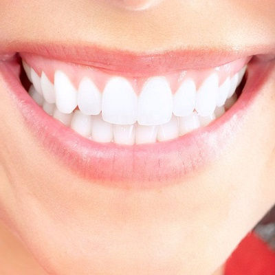 Teeth Whitening Clinic in Dubai