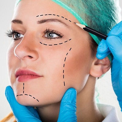 Best Forehead Lift in Muscat