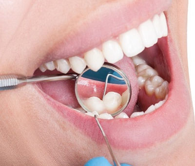 How Meditation and Mindfulness Can Help Stop Teeth Grinding