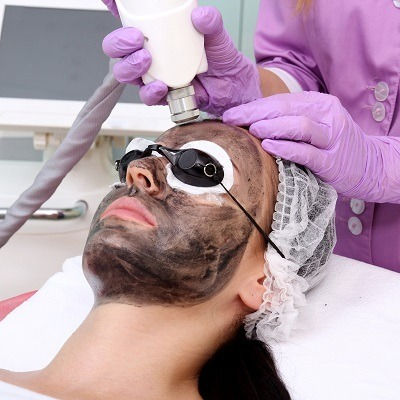 Best Laser Carbon Peel in Muscat