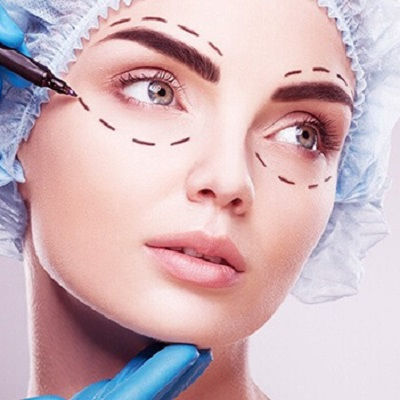 Best Eyelid Surgery Muscat