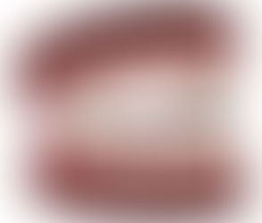 How Do Dental Implants Impact Facial Structure in Dubai?