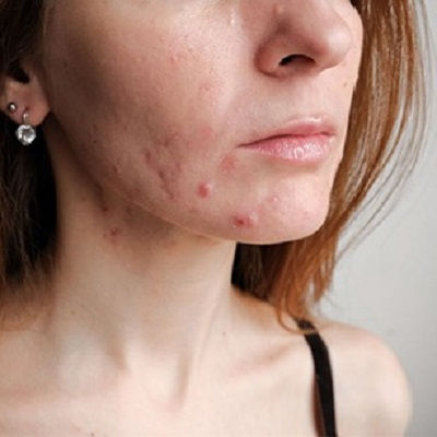 Best Dermatologist in Muscat