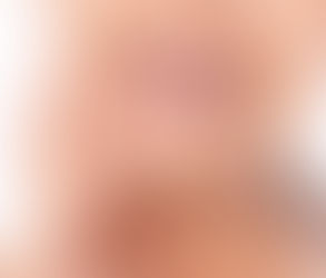 Boosting Confidence with a Brighter Smile: Teeth Whitening in Dubai