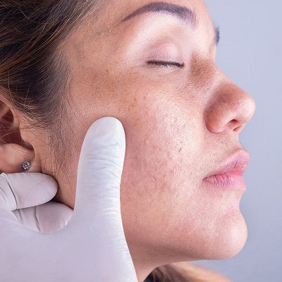 Dermatologist Near Me