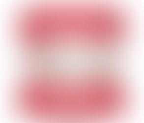 Understanding Overlapping Teeth: Causes and Solutions