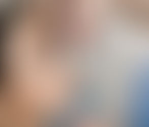 ماذا تتوقع في يوم جراحة تجميل الأنف