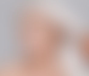 Understanding the Aftercare Process for Profhilo Treatment