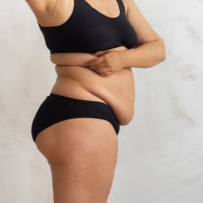 Best Post Weight Loss in Oman