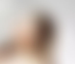 الفرق بين جوفيديرم فولبيلا وجوفيديرم ألترا