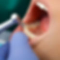 Teeth Cleaning: What to Expect at Your First Visit