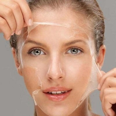Best TCA Peel Muscat