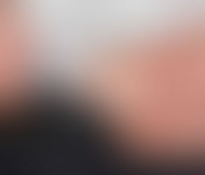 حقن مونجارو للمبتدئين: دليل بسيط خطوة بخطوة