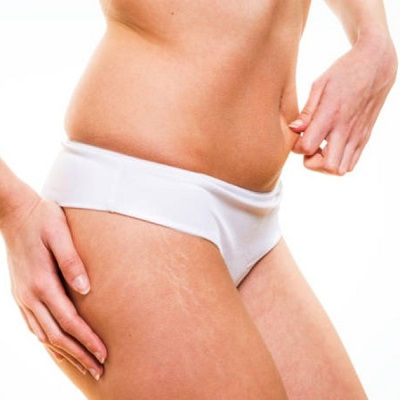Best Vaser 4D Liposuction in Muscat