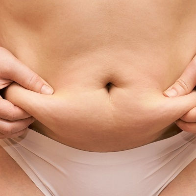 Best Post Weight Loss in Muscat