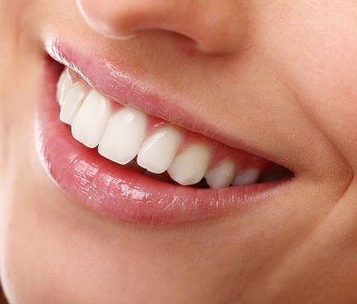 Can Hollywood Smile Design Fix Crooked Teeth?