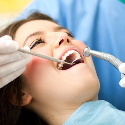 Best Composite Bonding Dubai