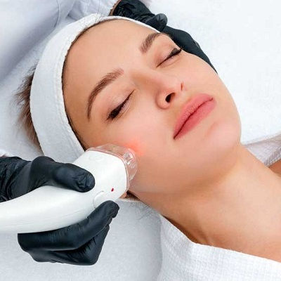 Fractional Co2 Treatment Muscat