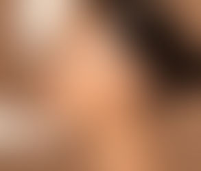 تطور تقنيات جراحة تجميل الأنف