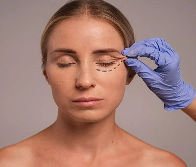 Understanding the Different Types of Blepharoplasty Procedures