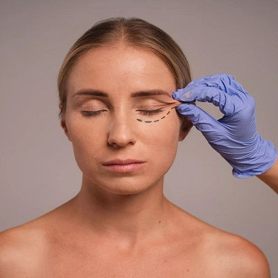 Blepharoplasty in Muscat