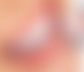 Debunking Myths About Digital Smile Design in Dentistry