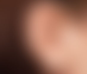 ما هي عملية إعادة تشكيل الأذن وكيف تتم؟