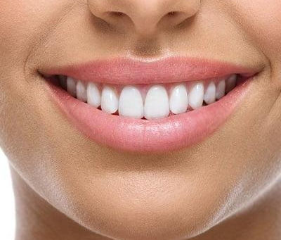 What Is a Hollywood Smile and Who Needs One?