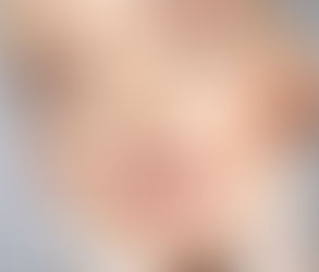 The Benefits of Dysport Injections for Wrinkle Reduction in Muscat